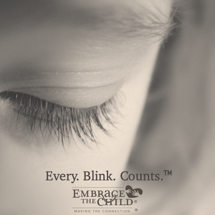 Every. Blink. Counts.